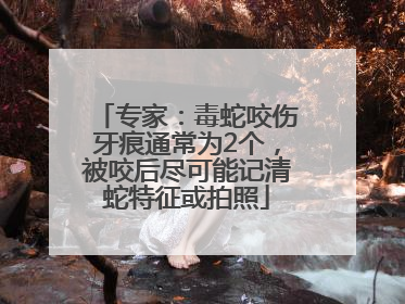 专家：毒蛇咬伤牙痕通常为2个，被咬后尽可能记清蛇特征或拍照